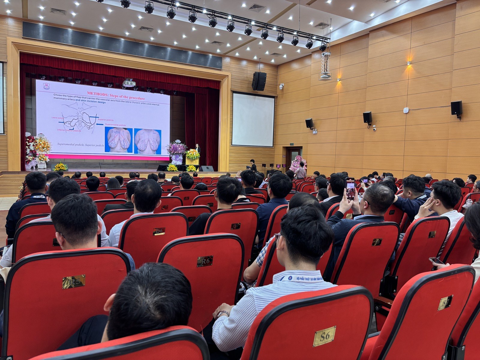 Hội trường hội nghị nhìn từ phía sau, trên màn hình là slide báo cáo tiếng Anh về các bước chọn vạt và cuống mạch trong tạo hình tuyến vú